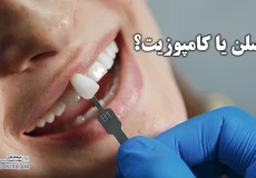ونیر دندانی