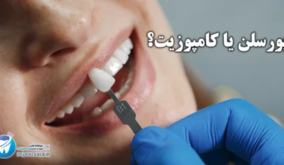 ونیر دندانی